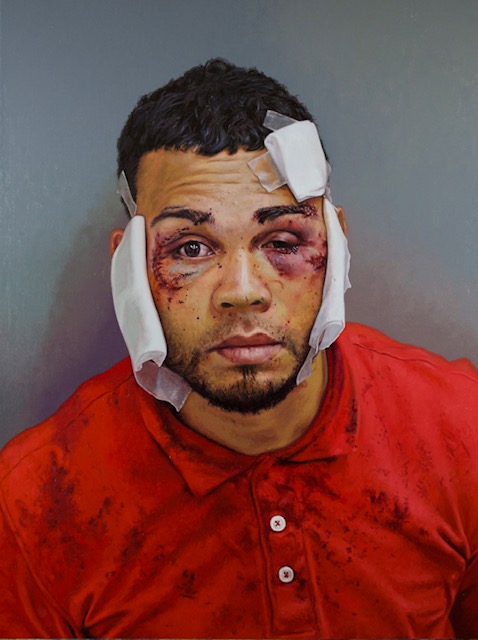 Image: Dick Dougherty, Arrested: J-120H29/720, 2020,, oil on linen covered panels, 24” x 36”. A painting of a portrait of a man looking at the camera for a mug shot. He has short black hair and is wearing a red shirt and bandages on his face. His face is cut and bruised. Photo provided by the artist.